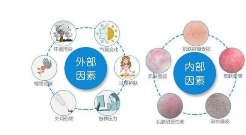 如何区分季节性敏感和过敏性肌肤?
